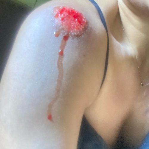Motociclista cai após atingir pedras soltas na Rua Capitão Hipólito e cobra providências da Prefeitura de Tarauacá
